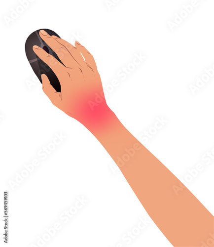 Vector illustration of hand with carpal tunnel syndrome using mouse