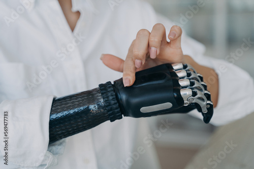 Hands of handicapped girl. Cyber prosthesis hand has processor chip, software and buttons.