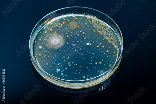 Vászonkép Petri dish with colonies of bacteria fungi on agar
