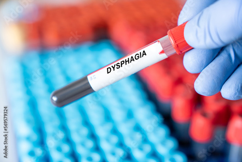 Dysphagia. Dysphagia disease blood test in doctor hand photo
