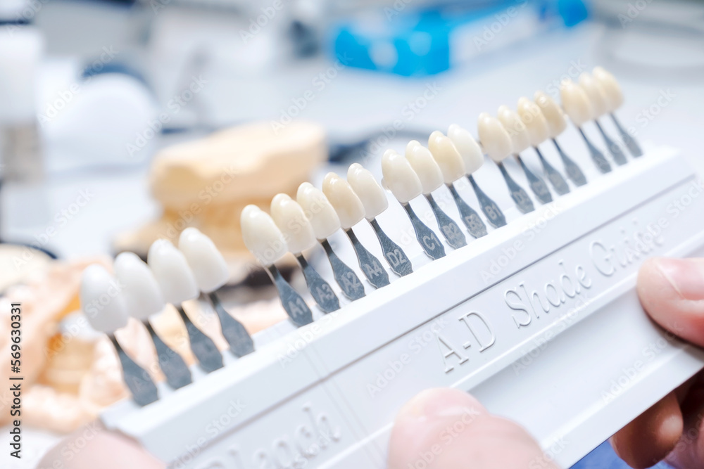 Close up of shade guide to check veneer of tooth crown in a dental laboratory Close up of shade guide to check veneer of tooth crown in a dental laboratory