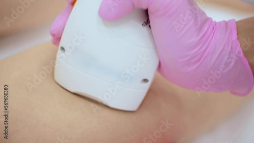 cosmetologist performs laser hair removal of the patient's legs in a modern cosmetology clinic. Hardware cosmetology