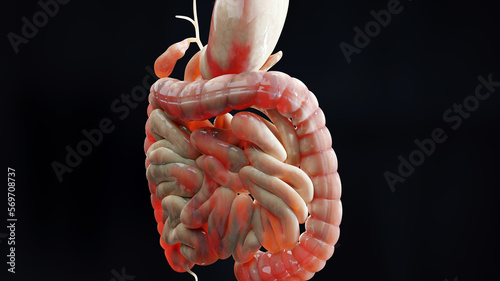 man suffering from crohns disease, male anatomy, inflamed large intestine, Sigmoid Colon, human digestive system parts, 3d render photo