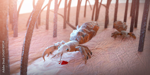 Quadro em tela head louse on a human head 3d render
