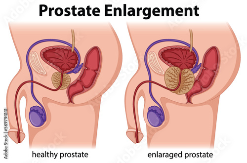 Inside the male reproductive system