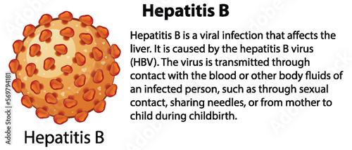 Hepatitis B with explanation