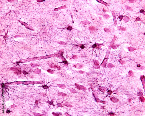 Cerebral cortex. Protoplasmic astrocytes