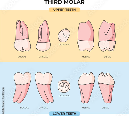 Anatomical view of the upper and lower teeth of the Third Molar in various angles and explanations