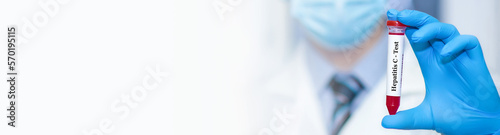 Doctor holding a test blood sample tube positive with hepatitis C virus (HCV) test.Banner. Copy space for text photo