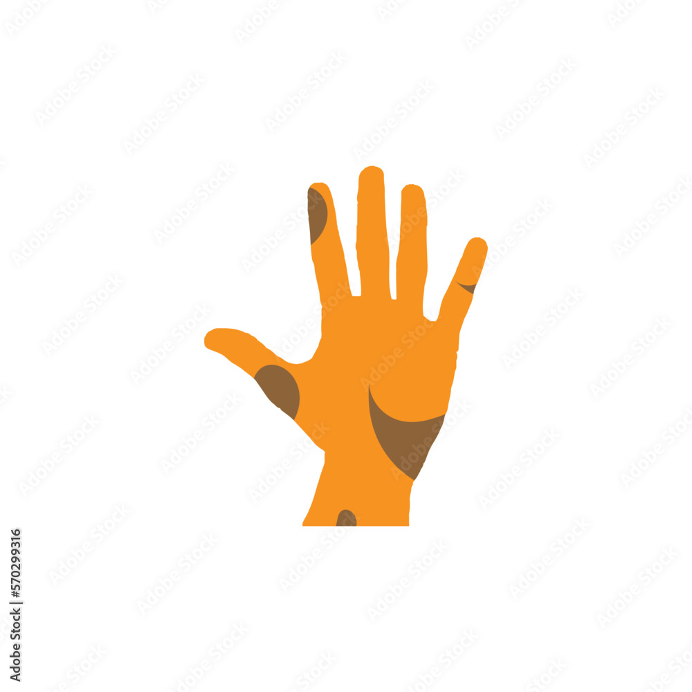 Obraz premium Leprosy hand icon. World leprosy day poster symbol.