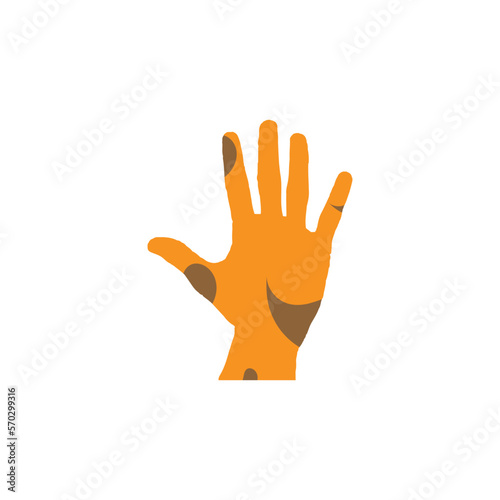 Leprosy hand icon. World leprosy day poster symbol.