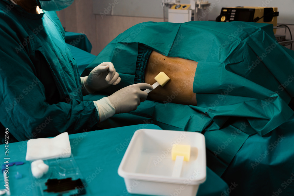 Doctor or surgeon apply betadine to the patient for anesthesia ...