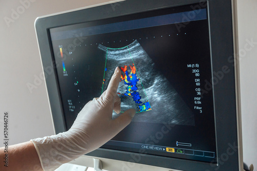 Young woman undergoing ultrasound scan in clinic