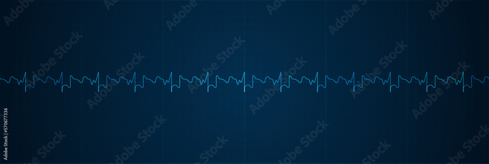 Fototapeta premium Emergency ekg monitoring. Blue glowing neon heart pulse. Heart beat. Electrocardiogram