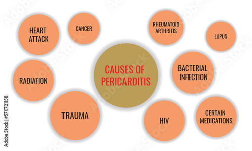 causes of pericarditis. Vector illustration for medical journal or brochure.
