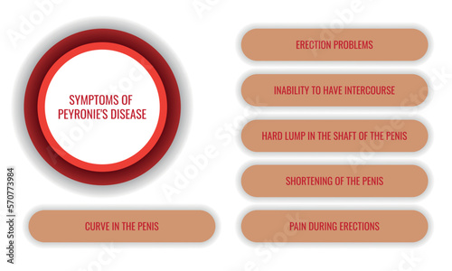 SYMPTOMS OF Peyronie's disease. Vector illustration for medical journal or brochure.