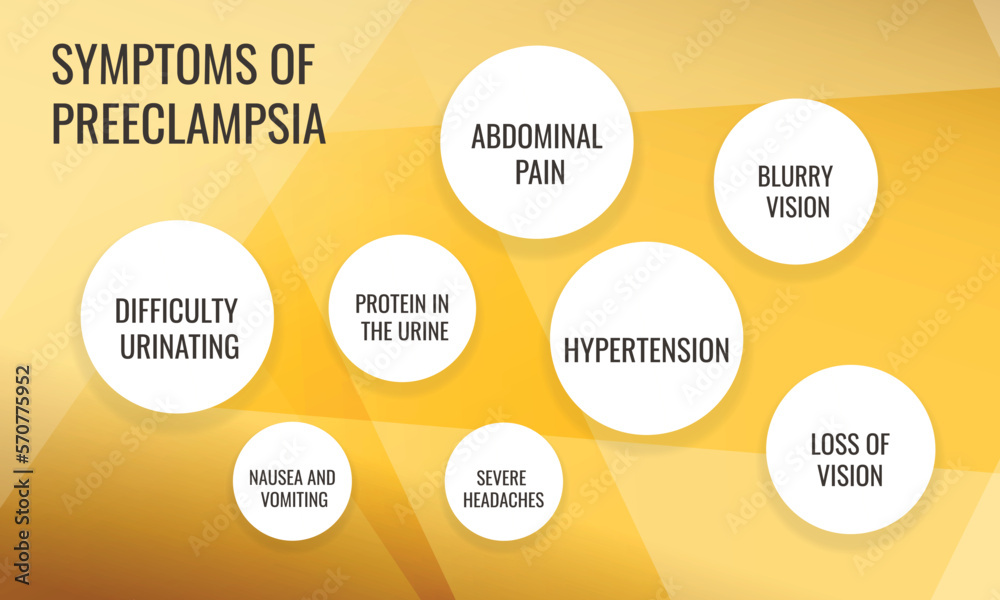 Symptoms Of Preeclampsia Vector Illustration For Medical Journal Or