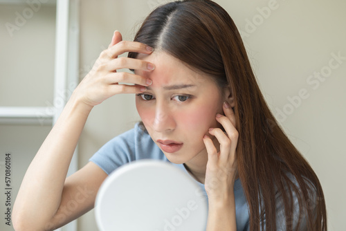 Fotobehang Dermatology, scratch asian young woman looking at mirror, expression worry and itch, itchy allergy or allergic sensitive reaction, red spot or rash on her face