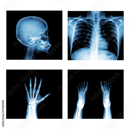 Many x-ray images of very good quality.
