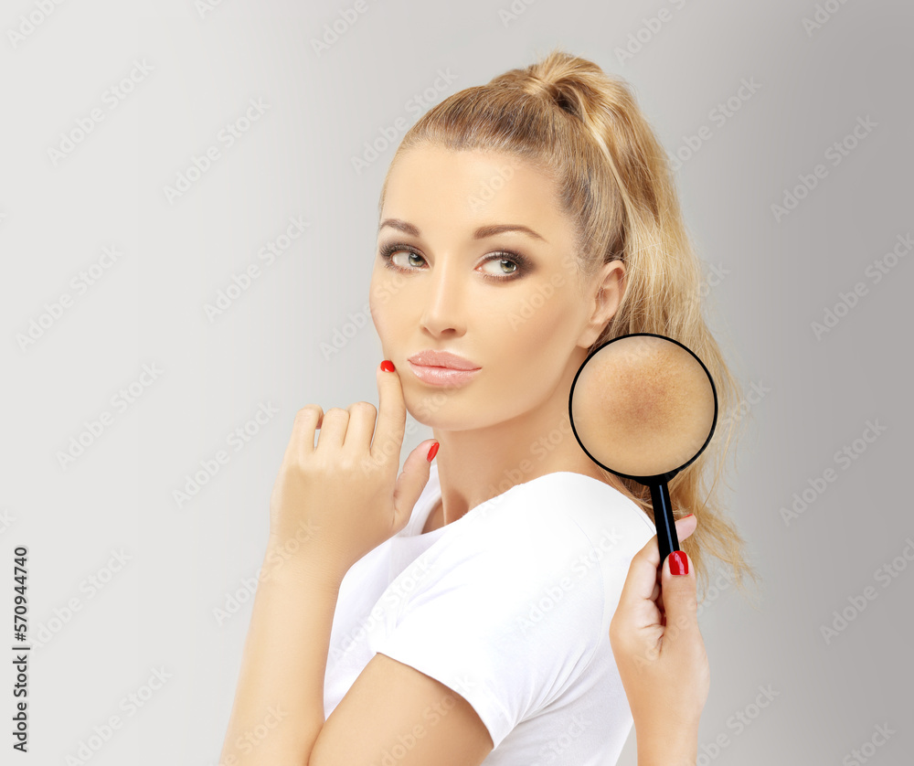 Dark spots, freckles,hyperpigmentation(melasma or chloasma),concept - skin lightening, skin whitening, fruit acids,AHA, Skin Brightening Dark spots, freckles,hyperpigmentation(melasma or chloasma),concept - skin lightening, skin whitening, fruit acids,AHA, Skin Brightening