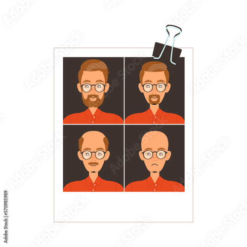 Man on Photograph Gradually Losing His Hair Suffer from Alopecia or Baldness Vector Illustration