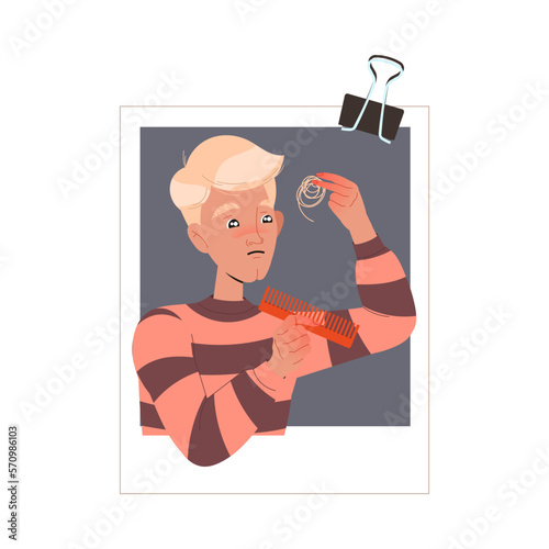 Blond Man with Wig Clump Losing His Hair Suffer from Alopecia or Baldness Vector Illustration