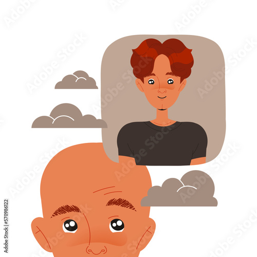 Bald Man Lost His Hair Suffer from Alopecia or Baldness Remembering Before Vector Illustration