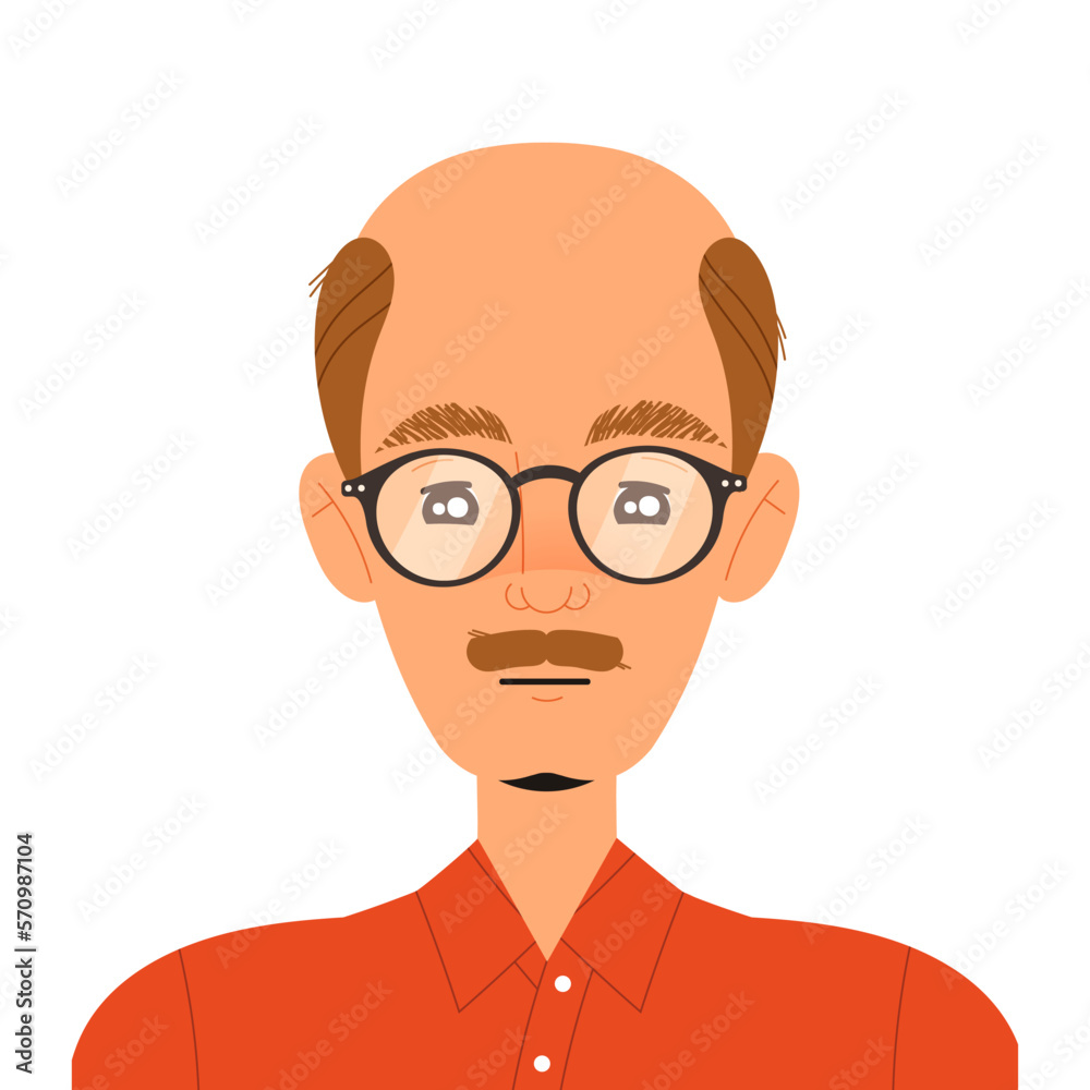 Man Losing His Hair Suffer from Alopecia or Baldness Vector Illustration