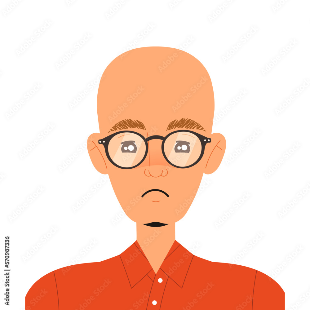 Man Losing His Hair Suffer from Alopecia or Baldness Vector Illustration