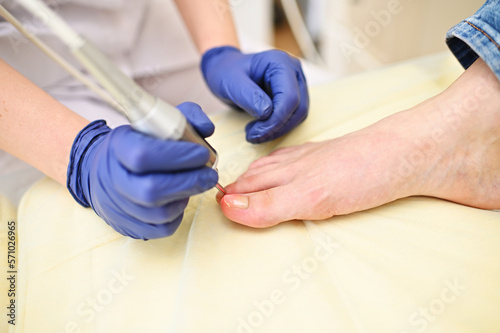 podologist is a woman using a laser to treat onychomycosis - a fungal nail disease. Hardware cosmetology