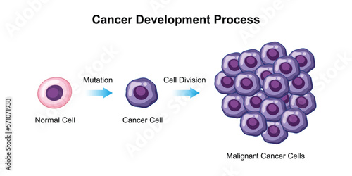 Scientific Designing of Cancer Development Process. Vector Illustration.