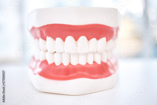 Dental, teeth model and orthodontics with healthcare and closeup, oral hygienist and health insurance. Veneers, dentistry equipment and healthy gums with fresh breath, medical and tooth care