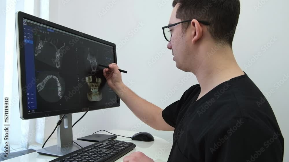 Tooth And Computer Video „Dentist doctor examines a panoramic x-ray of the jaw on a ...