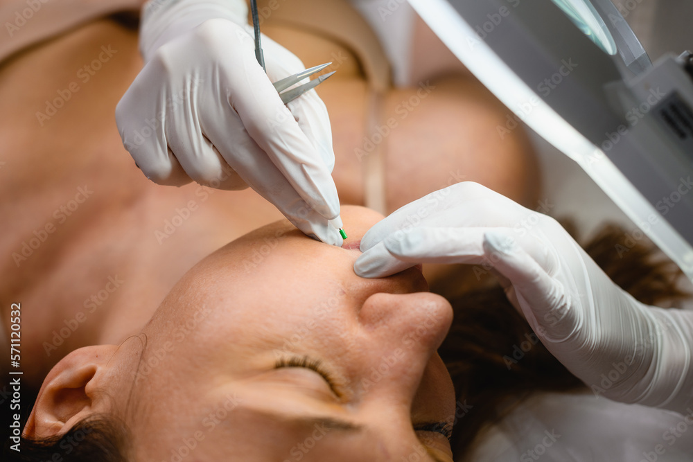 Cosmetologist in gloves put syringe in face Cosmetologist in gloves put syringe in face