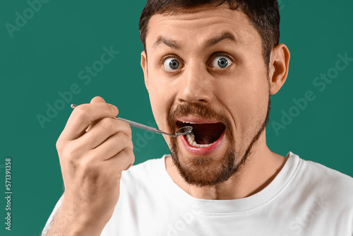 Young bearded man with dent...