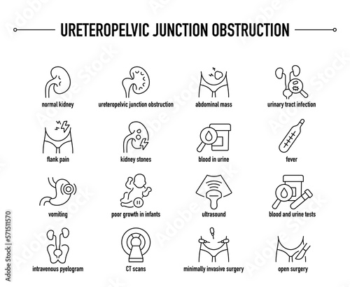 Ureteropelvic Junction Obstruction symptoms, diagnostic and treatment vector icon set. Line editable medical icons. photo