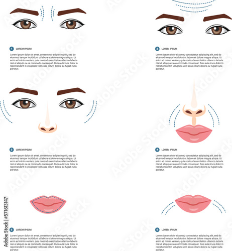 Contour plastic, mesotherapy and biorevitalization, impact zones on the face, vector