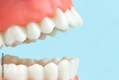 Dental prosthesis on blue background, close-up. Old age. Teeth. Jaw. Dental Model. Close up tooth model mock tooth on blue background, close-up.