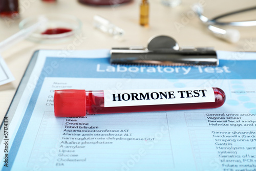 Hormone test. Sample tube with blood and laboratory form on table, closeup