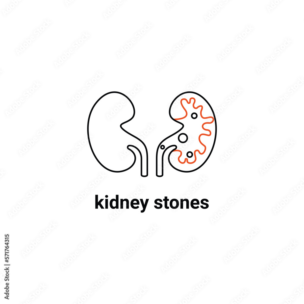 Fototapeta premium Human organ symbol, kidney stones problem. Modern vector line icons of urology. Linear medical pictogram for clinic, hospital. 