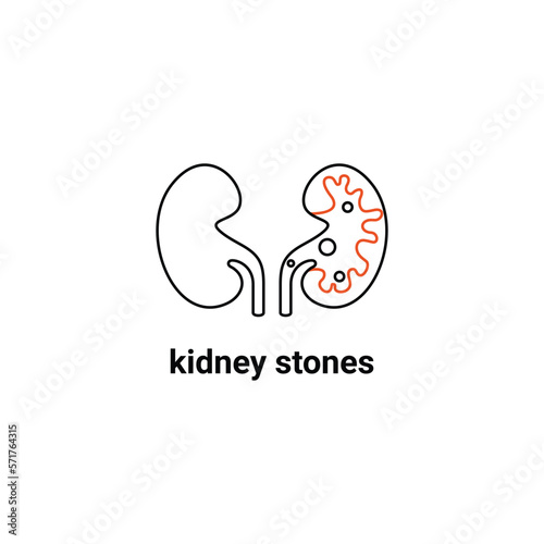 Human organ symbol, kidney stones problem. Modern vector line icons of urology. Linear medical pictogram for clinic, hospital. 