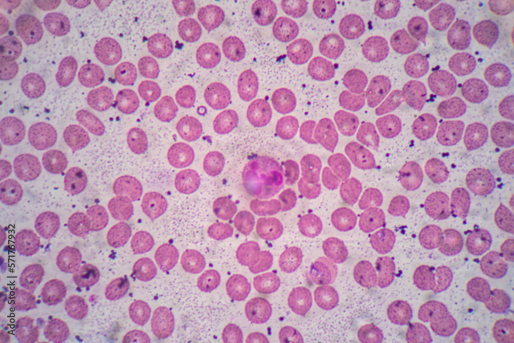 Human blood cells, Blood group and white blood cell study under microscopic.