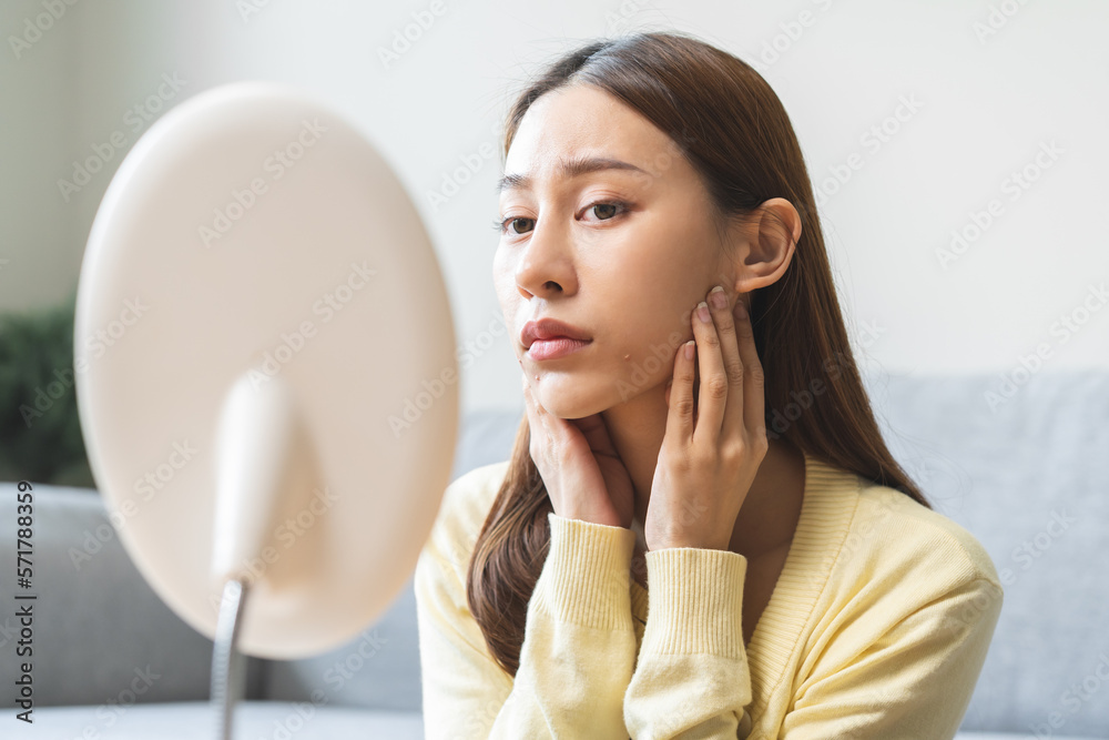 Expression worry asian young woman hand touching pustule around the chin and mouth, allergic when wear mask, makeup, show squeezing pimple spot from face. Beauty care, skin problem by acne treatment. Expression worry asian young woman hand touching pustule around the chin and mouth, allergic when wear mask, makeup, show squeezing pimple spot from face. Beauty care, skin problem by acne treatment.
