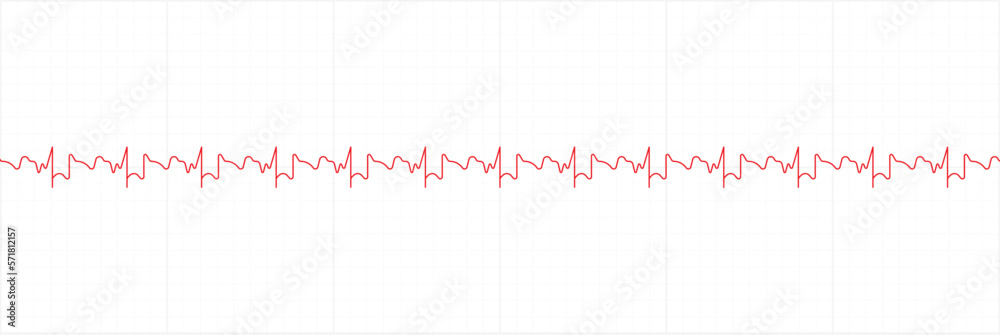 Electrocardiography heartbeat line monitor. Ecg Electrocardiography heartbeat line monitor. Ecg