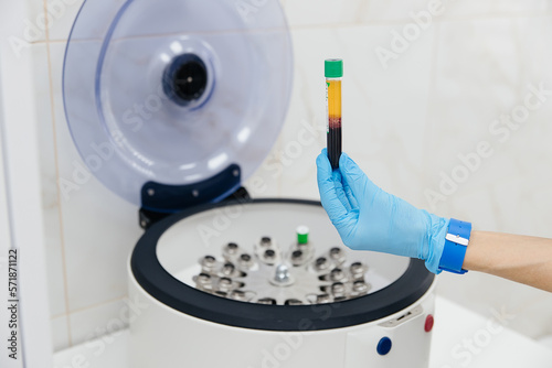 Tube with blood in hands. Centrifuge. Background