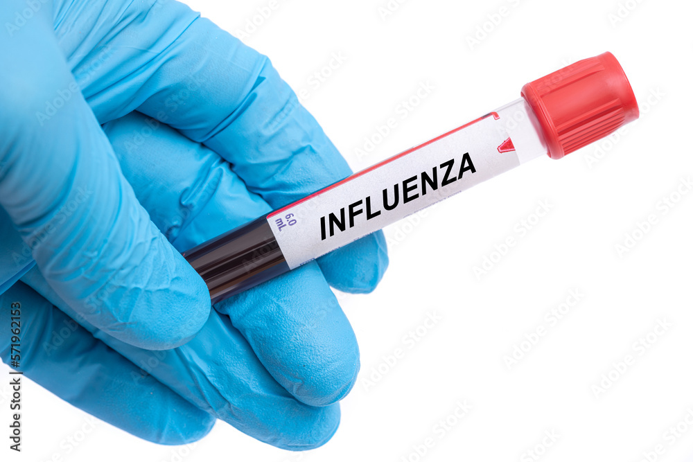 Obraz premium Influenza. Influenza disease blood test in doctor hand