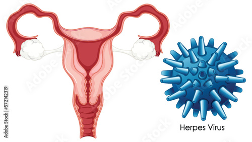 Vaginal infection bacteria concept