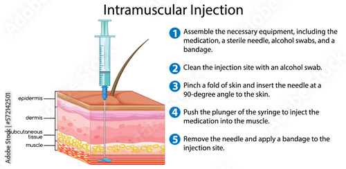Intramuscular Injection with explanation