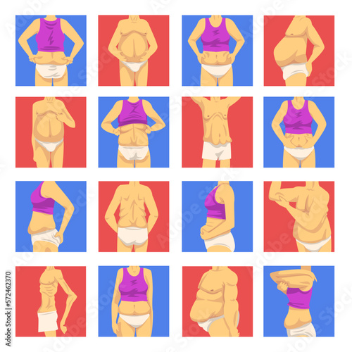 Male and Female Torso with Sagging Belly and Soft Muscles Big Vector Set