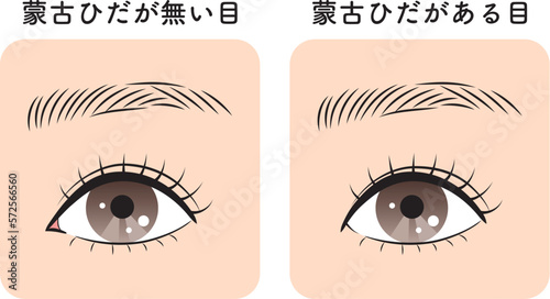 蒙古ひだがある目と無い目